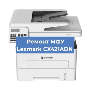 Замена лазера на МФУ Lexmark CX421ADN в Воронеже